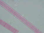 MISSING THUMBNAIL
